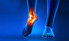 Lesiones de tobillo: ¿Qué son y por qué ocurren?
